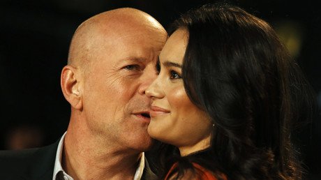 ¿Más atractivos y sanos?: La calvicie aporta inesperados beneficios