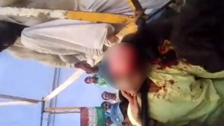 Una chica pierde su cuero cabelludo al hacerse un selfi junto a una noria