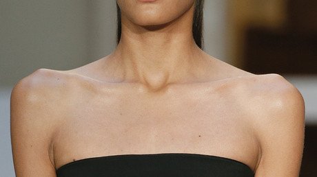 Autorizan a morir de hambre a una paciente anoréxica en EE.UU