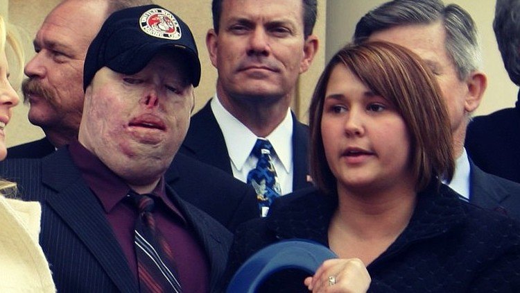 Luchó, volvió a nacer, murió: La desgarradora historia del soldado de EE.UU. desfigurado en Irak