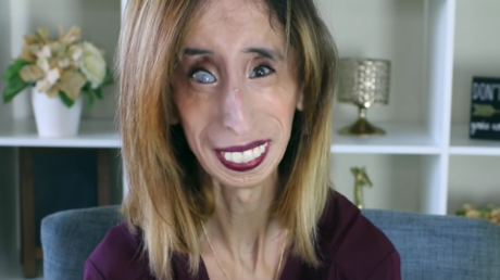 'La mujer más fea del mundo' responde tras ver su foto en memes