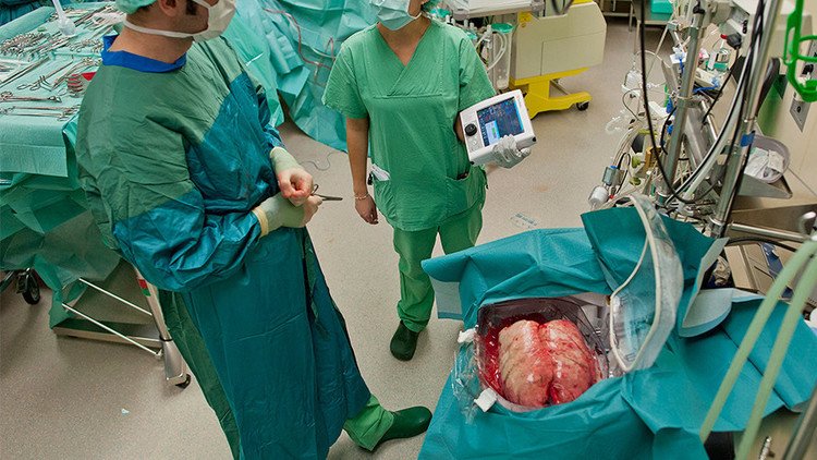 Una mujer sobrevive seis días sin pulmones 