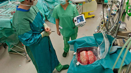 Una mujer sobrevive seis días sin pulmones