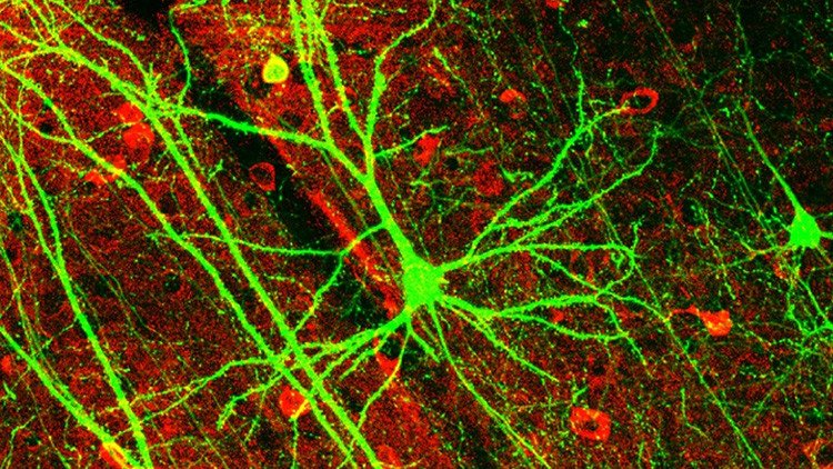 ¿Vida después de la muerte? Registran actividad cerebral en un fallecido durante 10 minutos