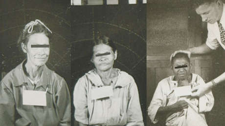 "Éticamente imposible": Así infectó EE.UU. a miles de guatemaltecos con sífilis hace 70 años