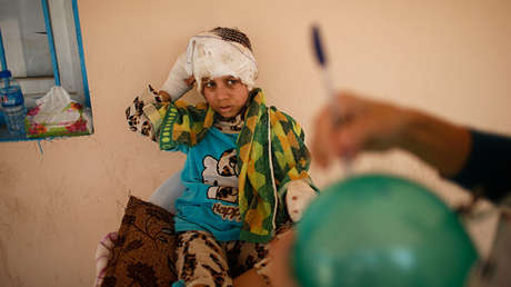 FUERTES IMÁGENES: Así sufren los horrores de la guerra los niños de Mosul