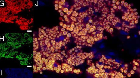 ¿Maravilla o monstruo? Hallan el primer espécimen vivo de un legendario gusano gigante (VIDEO)