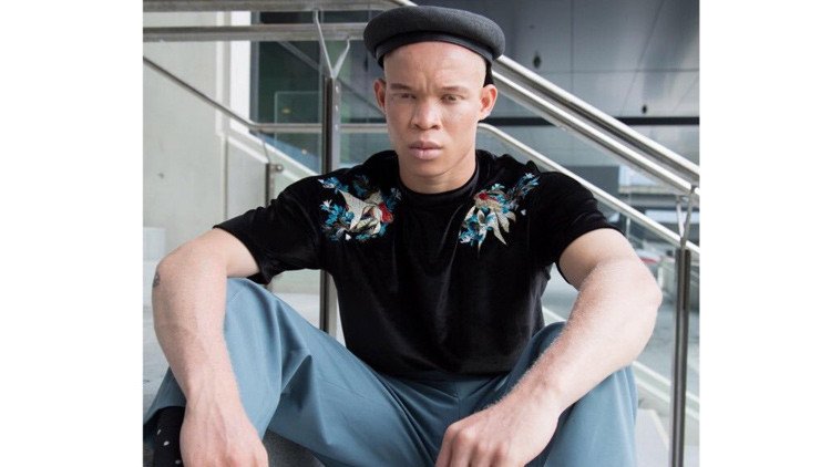 Un albino africano que escapó de los brujos de su país encuentra trabajo como modelo en Australia