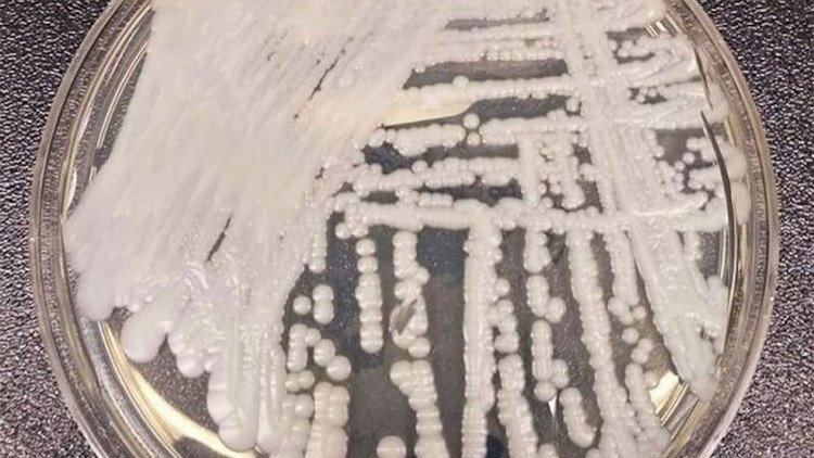Un hongo infeccioso mortal se expande por Estados Unidos 