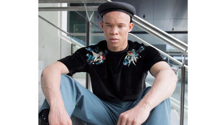 Un albino africano que escapó de los brujos de su país encuentra trabajo como modelo en Australia