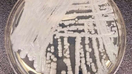 Un hongo infeccioso mortal se expande por Estados Unidos