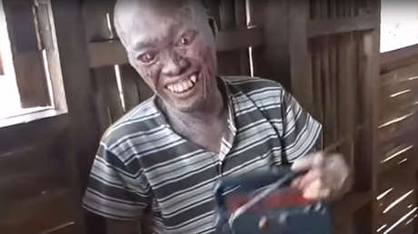 Lo consideran un demonio por sufrir una rara enfermedad de la piel