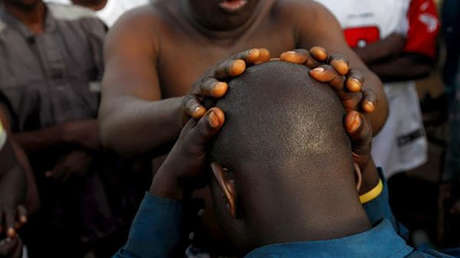 "Tienen oro en la cabeza": en este país africano ser calvo es muy peligroso