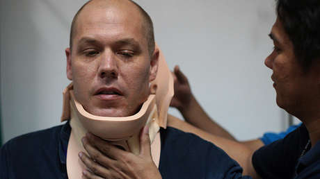 Una bala en el cuello: Corresponsal de guerra se salva de milagro en Filipinas (FOTOS)