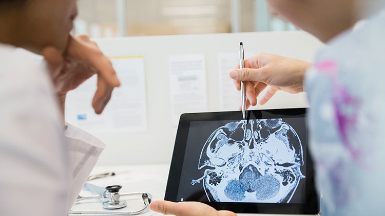 VIDEO: Una nueva técnica permite ver cómo se propaga la metástasis en el cerebro