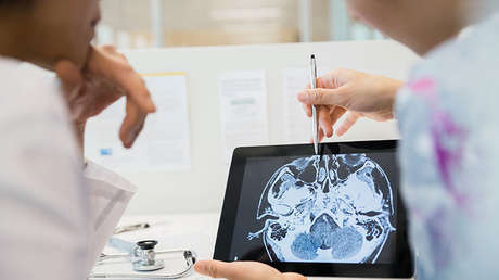 VIDEO: Una nueva técnica permite ver cómo se propaga la metástasis en el cerebro