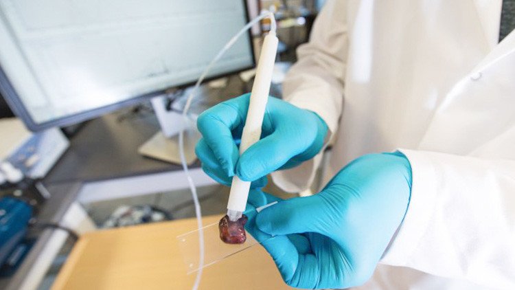 Ya se puede diagnosticar si tiene cáncer en tan sólo 10 segundos