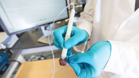 Ya se puede diagnosticar si tiene cáncer en tan sólo 10 segundos