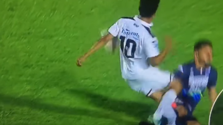 No apto para sensibles: Así fue la espeluznante fractura de tibia y peroné de un futbolista 