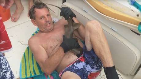 IMPACTANTE: Pequeño tiburón muerde a un hombre en el vientre y no lo suelta