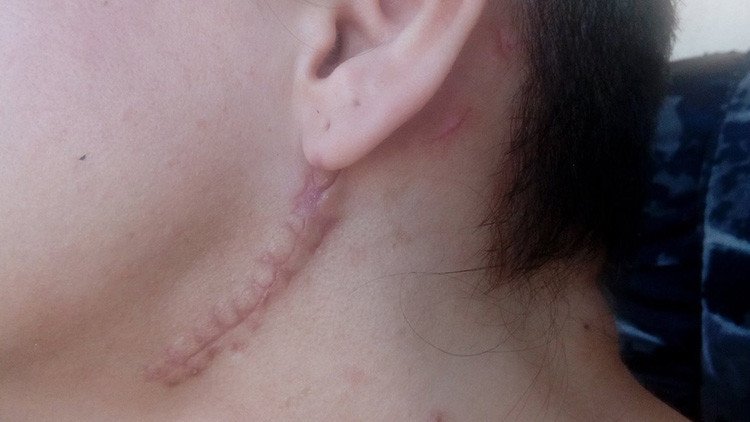 FUERTES IMÁGENES: Ex esclava sexual muestra las lesiones que le causaron sus captores