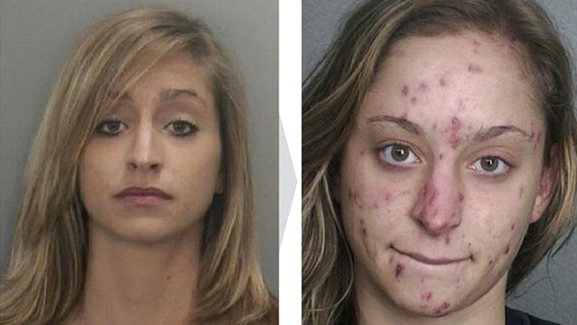 "Emergencia nacional": Vea a estas personas antes y después de que las drogas entraran en sus vidas