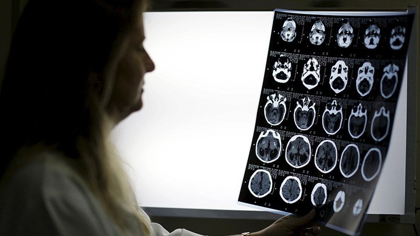 Descubren que la mente sigue funcionando cuando el cuerpo ya no da señales de vida