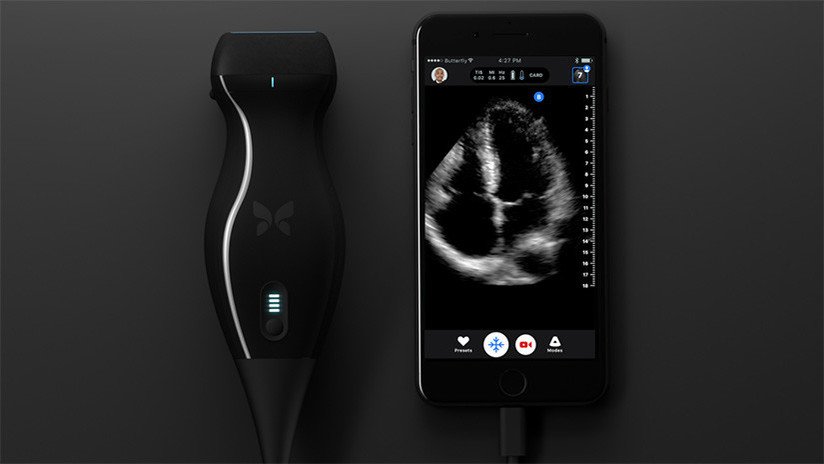 Un médico se auto-diagnosticó cáncer de cuello gracias a un dispositivo para iPhone (VIDEO)