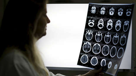 Descubren que la mente sigue funcionando cuando el cuerpo ya no da señales de vida