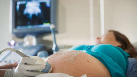 "Dando a luz a Voldemort": Terrorífico ultrasonido de un bebé en el vientre se hace viral (FOTO)