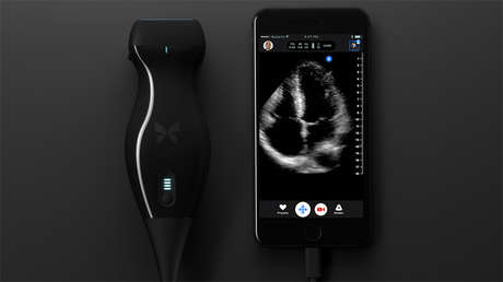 Un médico se auto-diagnosticó cáncer de cuello gracias a un dispositivo para iPhone (VIDEO)