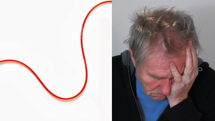 ¿Le han hecho alguna vez una transfusión de sangre? Sepa que corre riesgo de padecer alzhéimer 