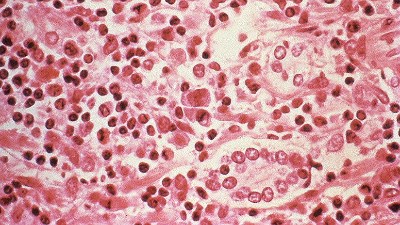 En este país latinoamericano un virus mortal ha aumentado su incidencia en un 81%