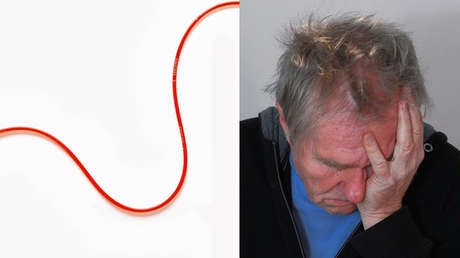 ¿Le han hecho alguna vez una transfusión de sangre? Sepa que corre riesgo de padecer alzhéimer