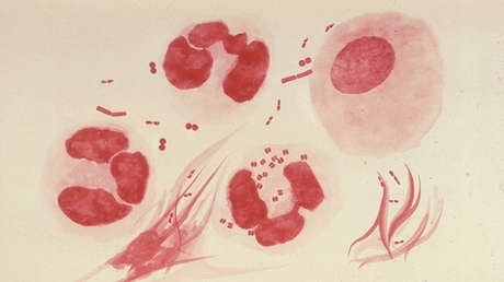La gonorrea requiere de nuevos fármacos para frenar su expansión