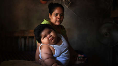 El insólito caso del bebé mexicano de 10 meses que pesa casi 30 kilogramos