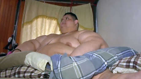 El médico que operó al hombre más obeso del mundo dice a RT que este vive sus horas más críticas