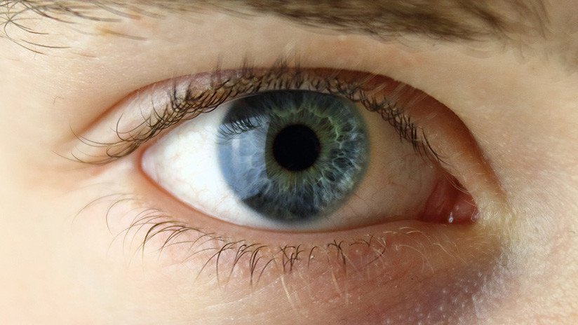 "Preferiría que me quitaran el ojo": La modelo con un tatuaje ocular fallido relata su suplicio