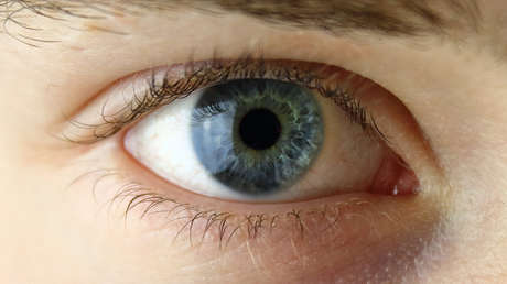 "Preferiría que me quitaran el ojo": La modelo con un tatuaje ocular fallido relata su suplicio