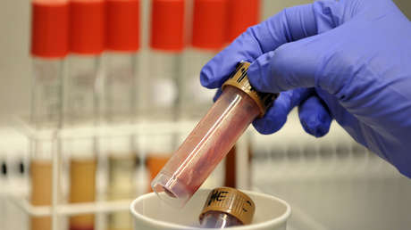 Japón no se explica el aumento de una rara enfermedad mortal causada por una 'bacteria carnívora'