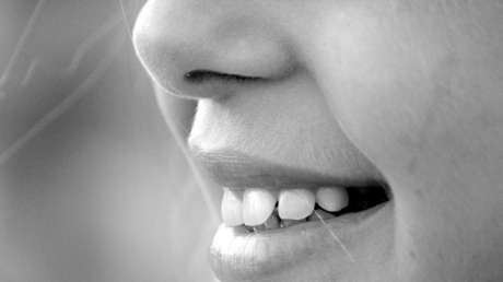 FOTOS IMPACTANTES: Una operación plástica fallida deja un agujero entre los ojos de una joven