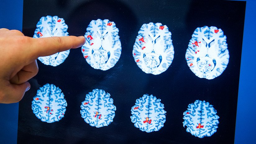 El cerebro femenino funciona mejor que el masculino durante la excitación sexual