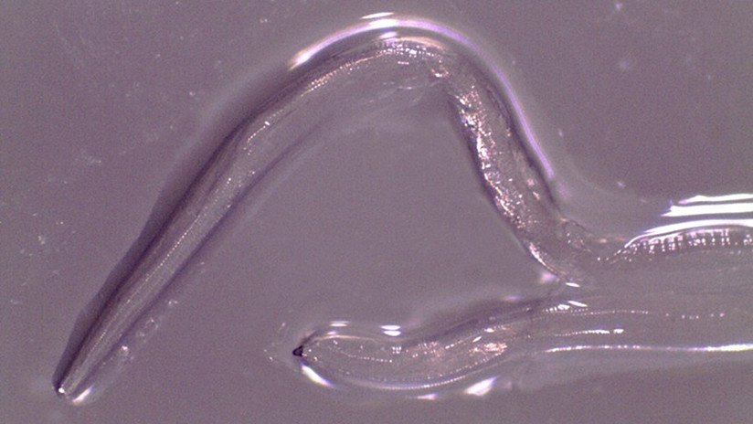 Extraen 14 gusanos del ojo de una mujer en EE.UU.