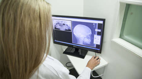 Una joven acude a un hospital de Moscú por "una bala incrustada en la frente"