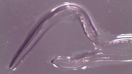 Extraen 14 gusanos del ojo de una mujer en EE.UU.