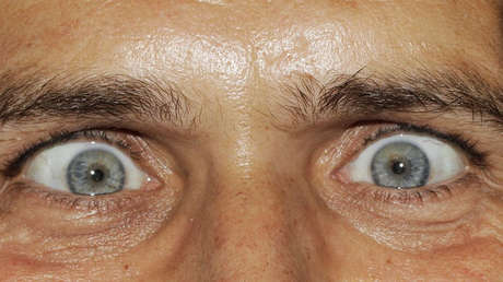 FOTO: Un gusano 'devorador' de cerebros crece en el ojo de un hombre