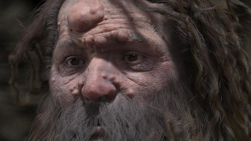 Reconstruyen el rostro del hombre de Cromañón y descubren que sufría de una dolencia genética