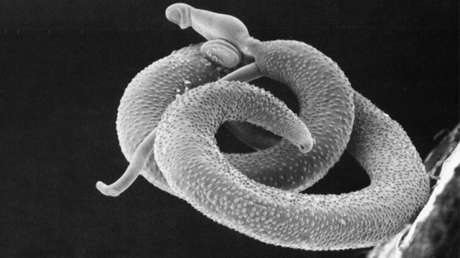 ¿Por qué todas estas personas se dejarían infectar por un temible gusano parásito?