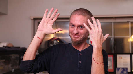 VIDEO: Se deja picar por la serpiente más letal de África y sobrevive