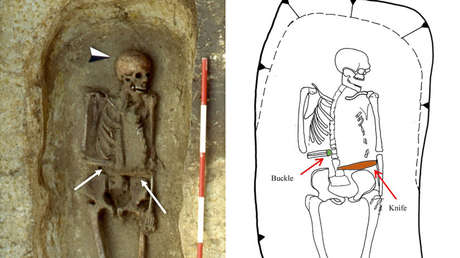 Sorpresa para antropólogos: Hallan en Italia un 'cíborg' medieval con un cuchillo en vez de mano